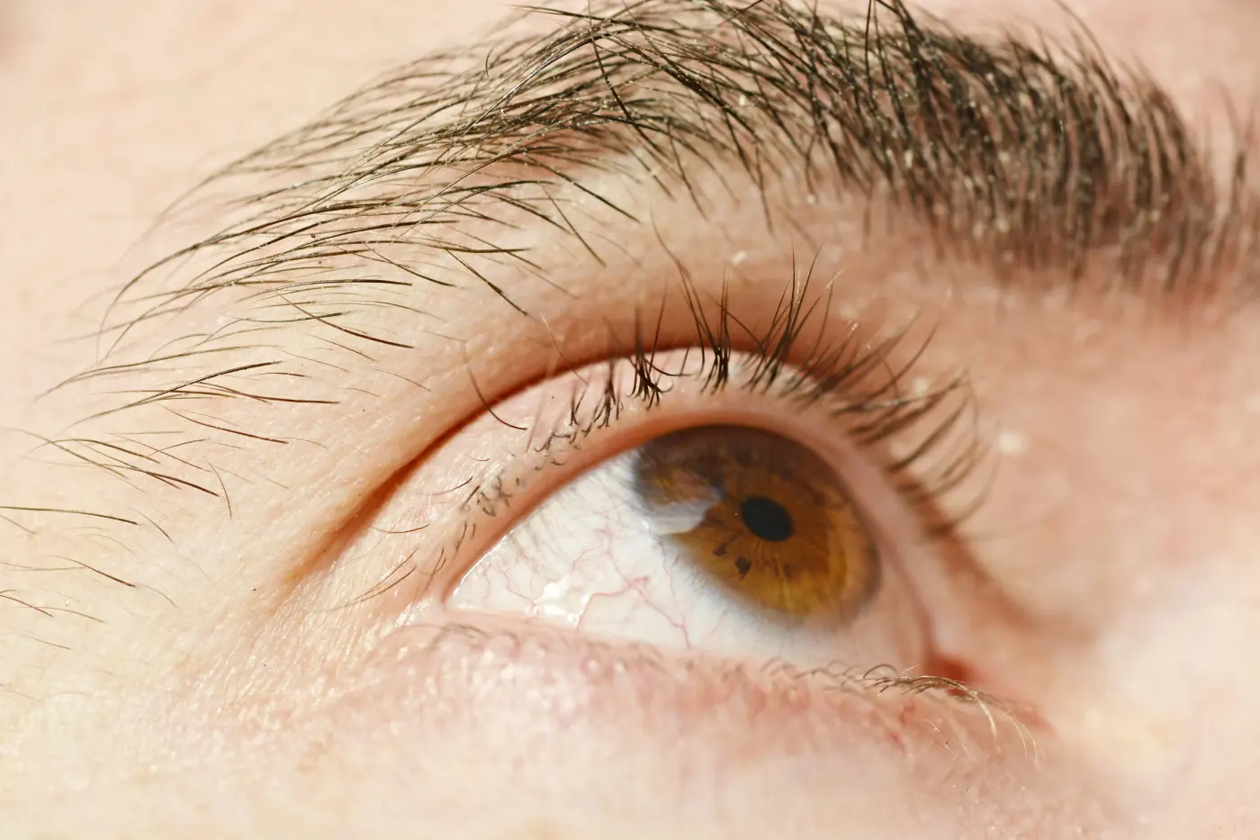 Skin and scalp care image representing seborrhoeic dermatitis treatment